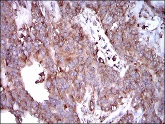 Anti-STAT5A antibody [6D4] used in IHC (Paraffin sections) (IHC-P). GTX60652