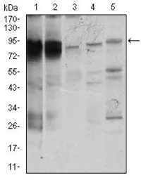 Anti-STAT5A antibody [6D4] used in Western Blot (WB). GTX60652
