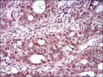 Anti-Brachyury antibody [1H9A2] used in IHC (Paraffin sections) (IHC-P). GTX60654