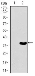 Anti-Brachyury antibody [1H9A2] used in Western Blot (WB). GTX60654