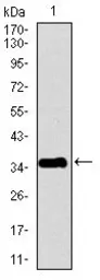 Anti-Pancreatic Polypeptide antibody [2G5D12] used in Western Blot (WB). GTX60662