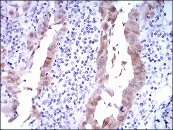 Anti-CDKN2A / p16INK4a antibody [1D7D2] used in IHC (Paraffin sections) (IHC-P). GTX60663