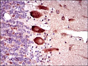 Anti-KEAP1 antibody [7G4B10] used in IHC (Paraffin sections) (IHC-P). GTX60664