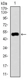 Anti-KEAP1 antibody [7G4B10] used in Western Blot (WB). GTX60664