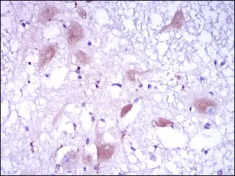 Anti-DKK3 antibody [8A5C6] used in IHC (Paraffin sections) (IHC-P). GTX60665