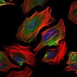 Anti-ATP citrate lyase antibody [5F8D11] used in Immunocytochemistry/ Immunofluorescence (ICC/IF). GTX60666