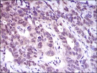 Anti-ATP citrate lyase antibody [5F8D11] used in IHC (Paraffin sections) (IHC-P). GTX60666