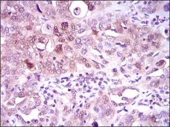 Anti-ATP citrate lyase antibody [5F8D11] used in IHC (Paraffin sections) (IHC-P). GTX60666