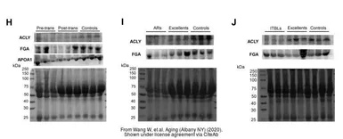 Anti-ATP citrate lyase antibody [5F8D11] used in Western Blot (WB). GTX60666