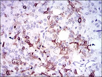 Anti-Osteopontin antibody [7C5H12] used in IHC (Paraffin sections) (IHC-P). GTX60672