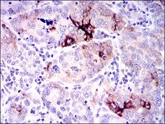 Anti-Osteopontin antibody [7C5H12] used in IHC (Paraffin sections) (IHC-P). GTX60672