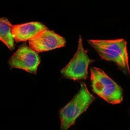 Anti-PSAP antibody [4D5F4] used in Immunocytochemistry/ Immunofluorescence (ICC/IF). GTX60673