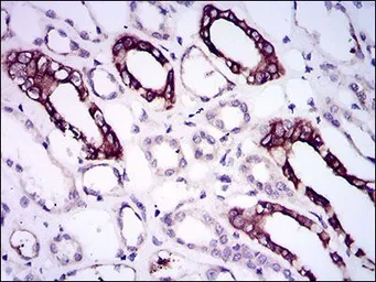 Anti-BMPR1A antibody [4B7B2] used in IHC (Paraffin sections) (IHC-P). GTX60675