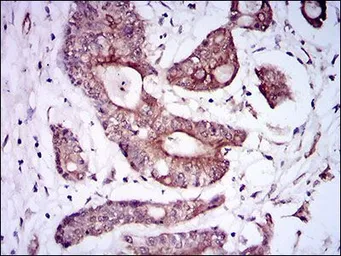 Anti-BMPR1A antibody [4B7B2] used in IHC (Paraffin sections) (IHC-P). GTX60675
