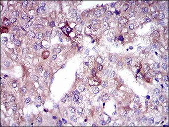 Anti-SLC27A5 antibody [4B11C10] used in IHC (Paraffin sections) (IHC-P). GTX60688
