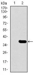 Anti-SLC27A5 antibody [4B11C10] used in Western Blot (WB). GTX60688