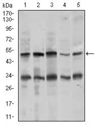 Anti-Chromogranin A antibody [1A6B6] used in Western Blot (WB). GTX60690