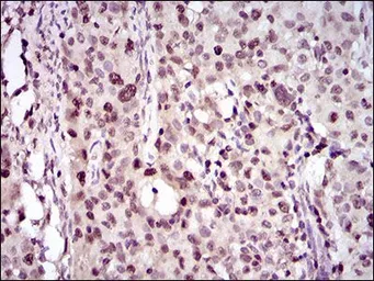 Anti-PCNA antibody [7H4F8] used in IHC (Paraffin sections) (IHC-P). GTX60692