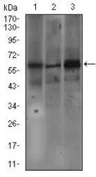 Anti-Fc epsilon R1 alpha antibody [1F2A9] used in Western Blot (WB). GTX60720