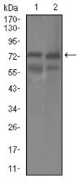 Anti-GUCY1A3 antibody [3G6B2] used in Western Blot (WB). GTX60721