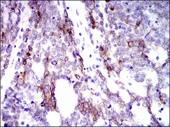 Anti-Cytokeratin 5 antibody [10C11E6] used in IHC (Paraffin sections) (IHC-P). GTX60722