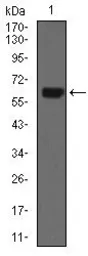 Anti-Cytokeratin 5 antibody [10C11E6] used in Western Blot (WB). GTX60722