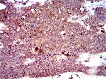 Anti-DCTN4 antibody [3G9D7] used in IHC (Paraffin sections) (IHC-P). GTX60723