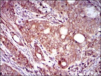 Anti-DCTN4 antibody [3G9D7] used in IHC (Paraffin sections) (IHC-P). GTX60723