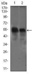 Anti-DCTN4 antibody [3G9D7] used in Western Blot (WB). GTX60723