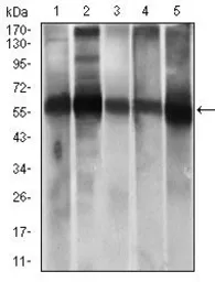 Anti-ALDH2 antibody [4G6A3] used in Western Blot (WB). GTX60727