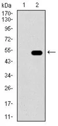 Anti-ALDH2 antibody [4G6A3] used in Western Blot (WB). GTX60727