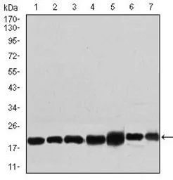 Anti-RPL18A antibody [6G6G10] used in Western Blot (WB). GTX60729