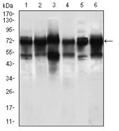 Anti-WHSC2 antibody [6B11H8] used in Western Blot (WB). GTX60733