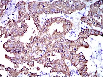 Anti-Cytokeratin 5 antibody [2C2B4] used in IHC (Paraffin sections) (IHC-P). GTX60749