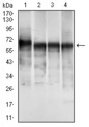 Anti-Cytokeratin 5 antibody [2C2B4] used in Western Blot (WB). GTX60749