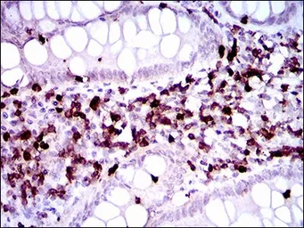 Anti-CD7 antibody [5B10E3] used in IHC (Paraffin sections) (IHC-P). GTX60755