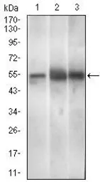 Anti-PAX3 antibody [7D8G7] used in Western Blot (WB). GTX60758