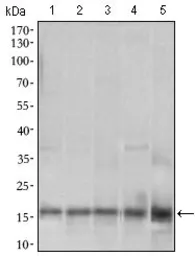 Anti-MRPL42 antibody [3H6H2] used in Western Blot (WB). GTX60760