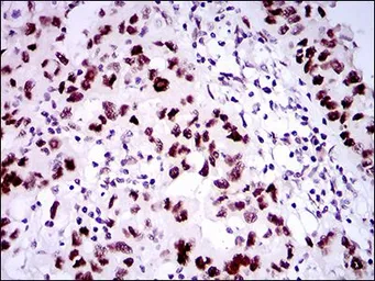 Anti-53BP1 antibody [6B3E10] used in IHC (Paraffin sections) (IHC-P). GTX60762