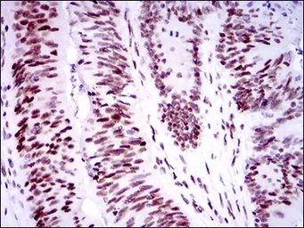 Anti-53BP1 antibody [6B3E10] used in IHC (Paraffin sections) (IHC-P). GTX60762