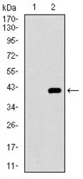 Anti-CD41 antibody [2E10C9] used in Western Blot (WB). GTX60763