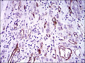 Anti-GSC antibody [4C5D5] used in IHC (Paraffin sections) (IHC-P). GTX60774