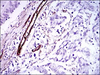 Anti-GSC antibody [4C5D5] used in IHC (Paraffin sections) (IHC-P). GTX60774