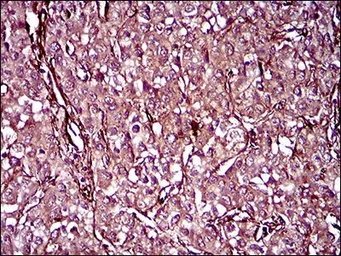 Anti-CD146 antibody [6C3E6] used in IHC (Paraffin sections) (IHC-P). GTX60775