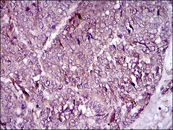 Anti-CD146 antibody [6C3E6] used in IHC (Paraffin sections) (IHC-P). GTX60775