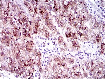 Anti-FLT3 antibody [7B7C3] used in IHC (Paraffin sections) (IHC-P). GTX60777
