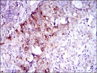 Anti-FLT3 antibody [7B7C3] used in IHC (Paraffin sections) (IHC-P). GTX60777