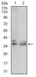 Anti-TRAP antibody [5C5E7] used in Western Blot (WB). GTX60778