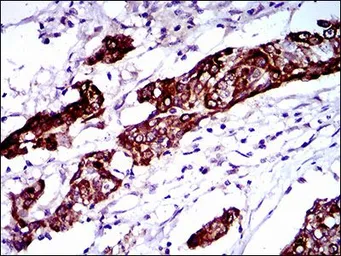 Anti-BRCA1 antibody [6C6D2] used in IHC (Paraffin sections) (IHC-P). GTX60779