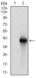 Anti-BRCA1 antibody [6C6D2] used in Western Blot (WB). GTX60779